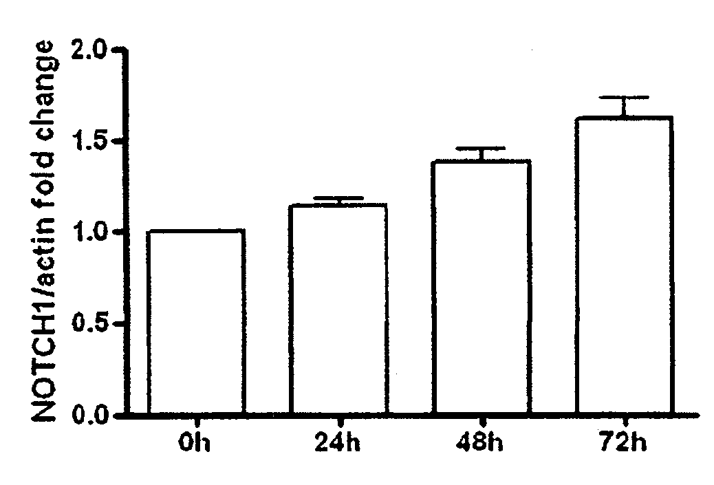 Method for generating islet beta cells from dedifferentiated exocrine pancreatic cells