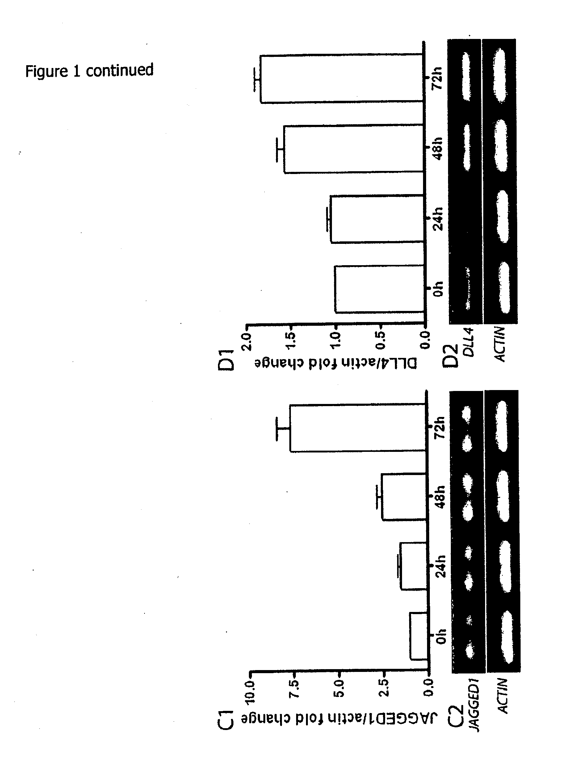 Method for generating islet beta cells from dedifferentiated exocrine pancreatic cells