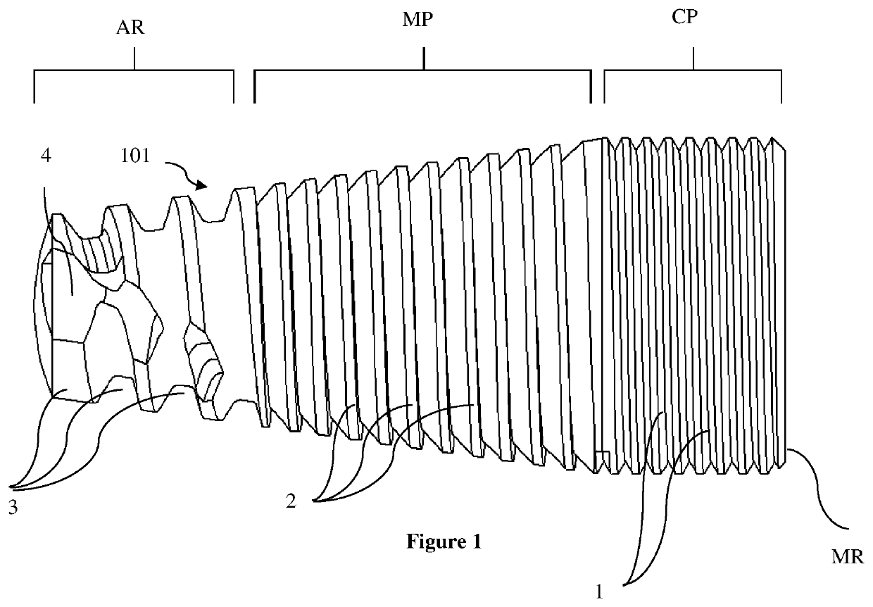 A dental implant assembly