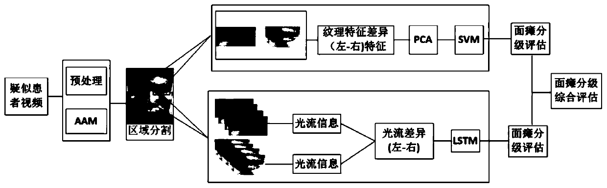 Facial paralysis grading comprehensive evaluation system combining facial textures and optical flow characteristics