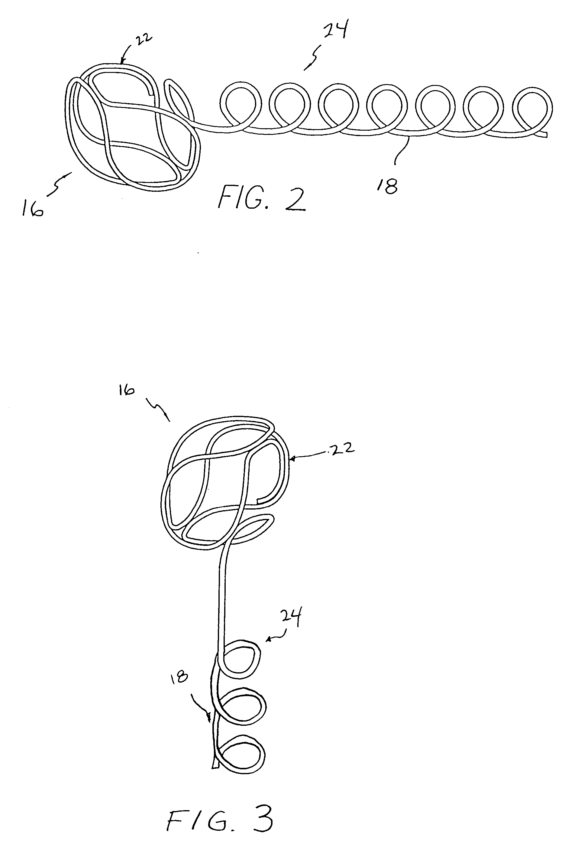 Anchored stent and occlusive device for treatment of aneurysms