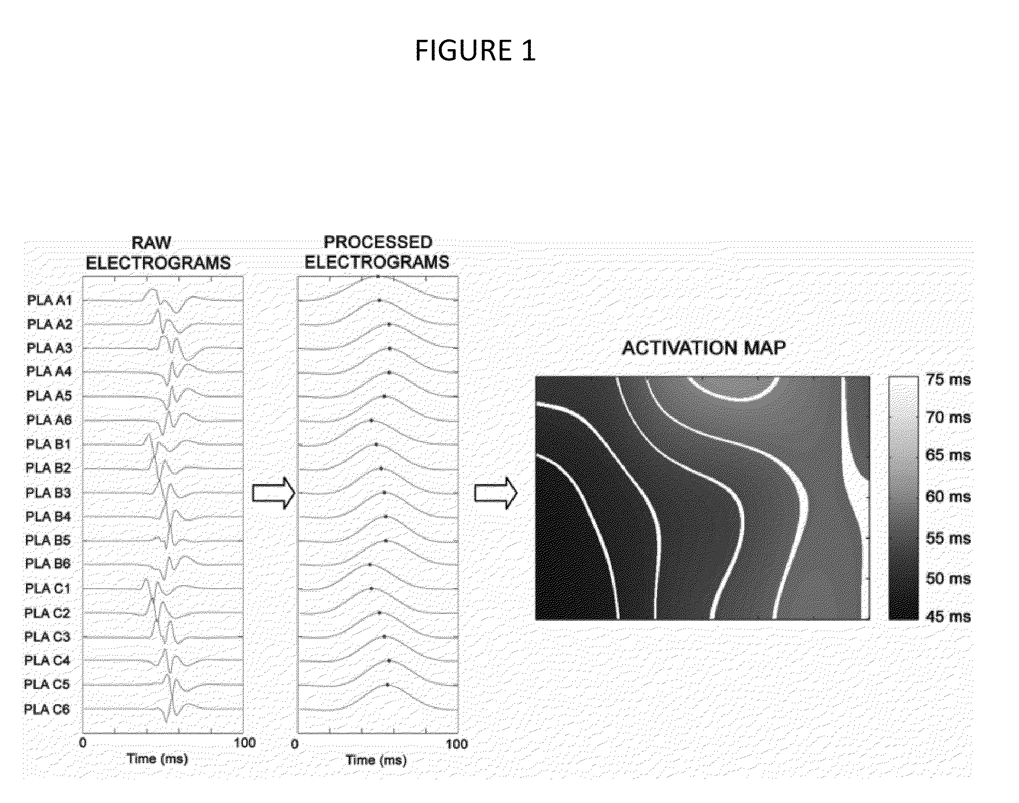 Compositions and methods for treating or preventing atrial fibrillation