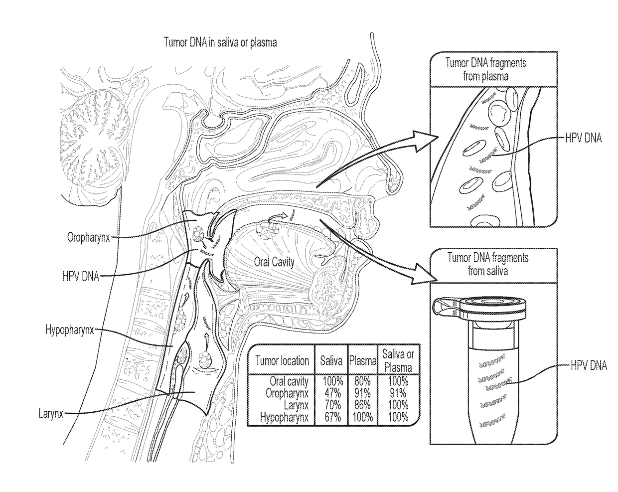 Head and neck squamous cell carcinoma assays