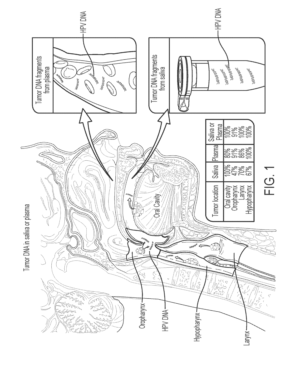 Head and neck squamous cell carcinoma assays