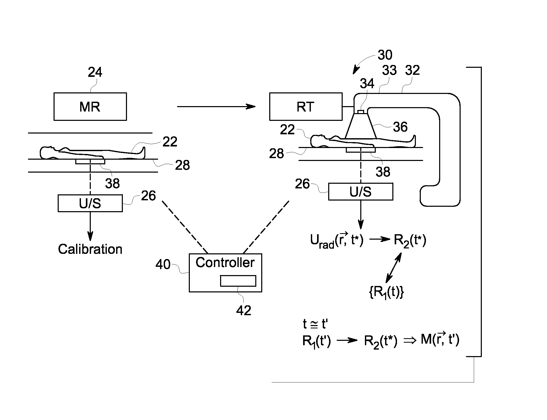 Methods and systems using magnetic resonance and ultrasound for tracking anatomical targets for radiation therapy guidance