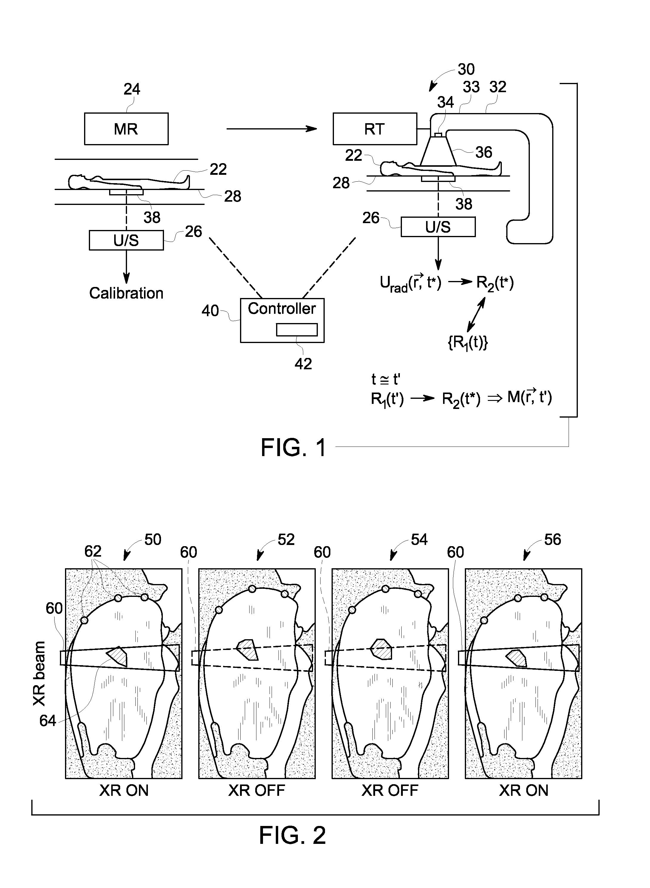 Methods and systems using magnetic resonance and ultrasound for tracking anatomical targets for radiation therapy guidance