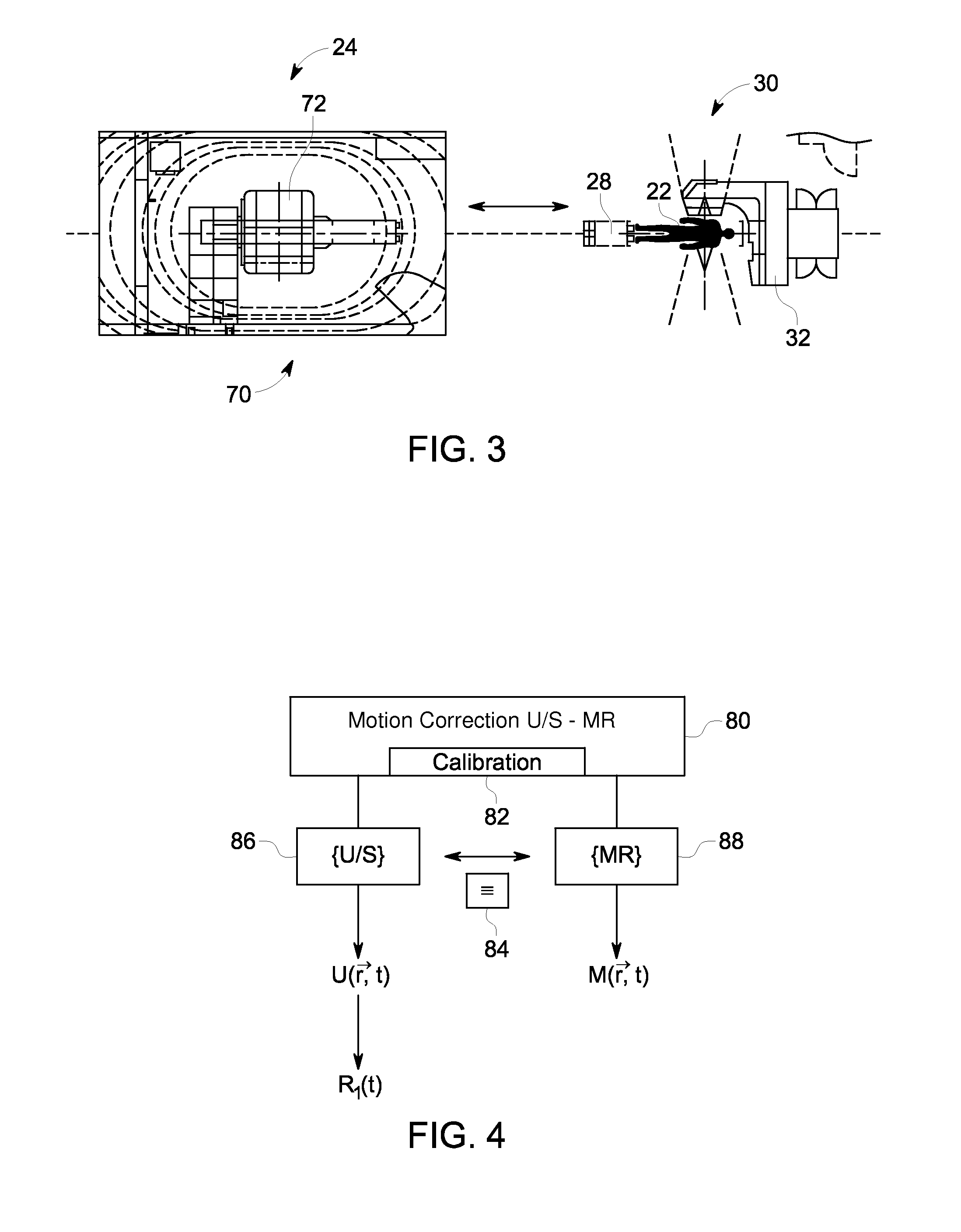 Methods and systems using magnetic resonance and ultrasound for tracking anatomical targets for radiation therapy guidance