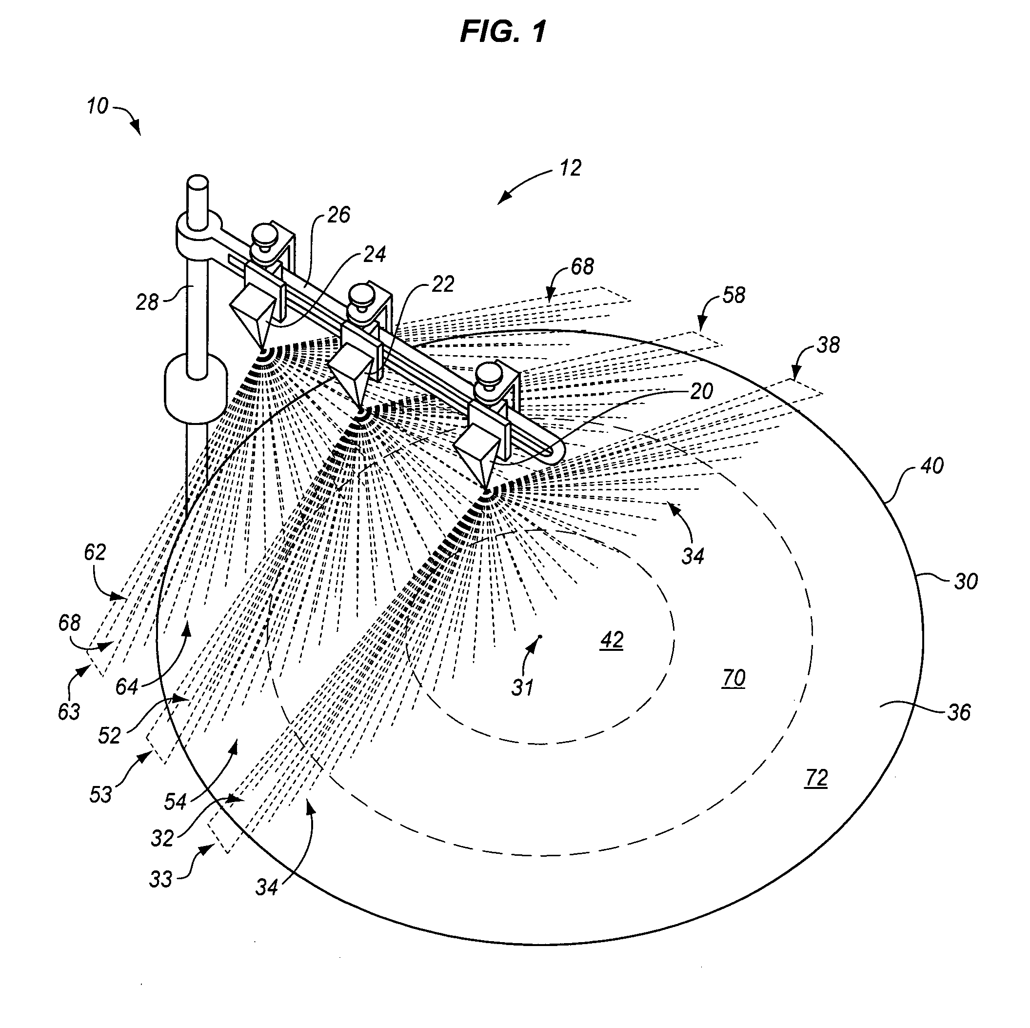 Modulated metal removal using localized wet etching