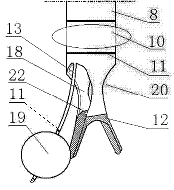 One-lung ventilation integrated device of single-cavity trachea catheter and bronchus blocking device