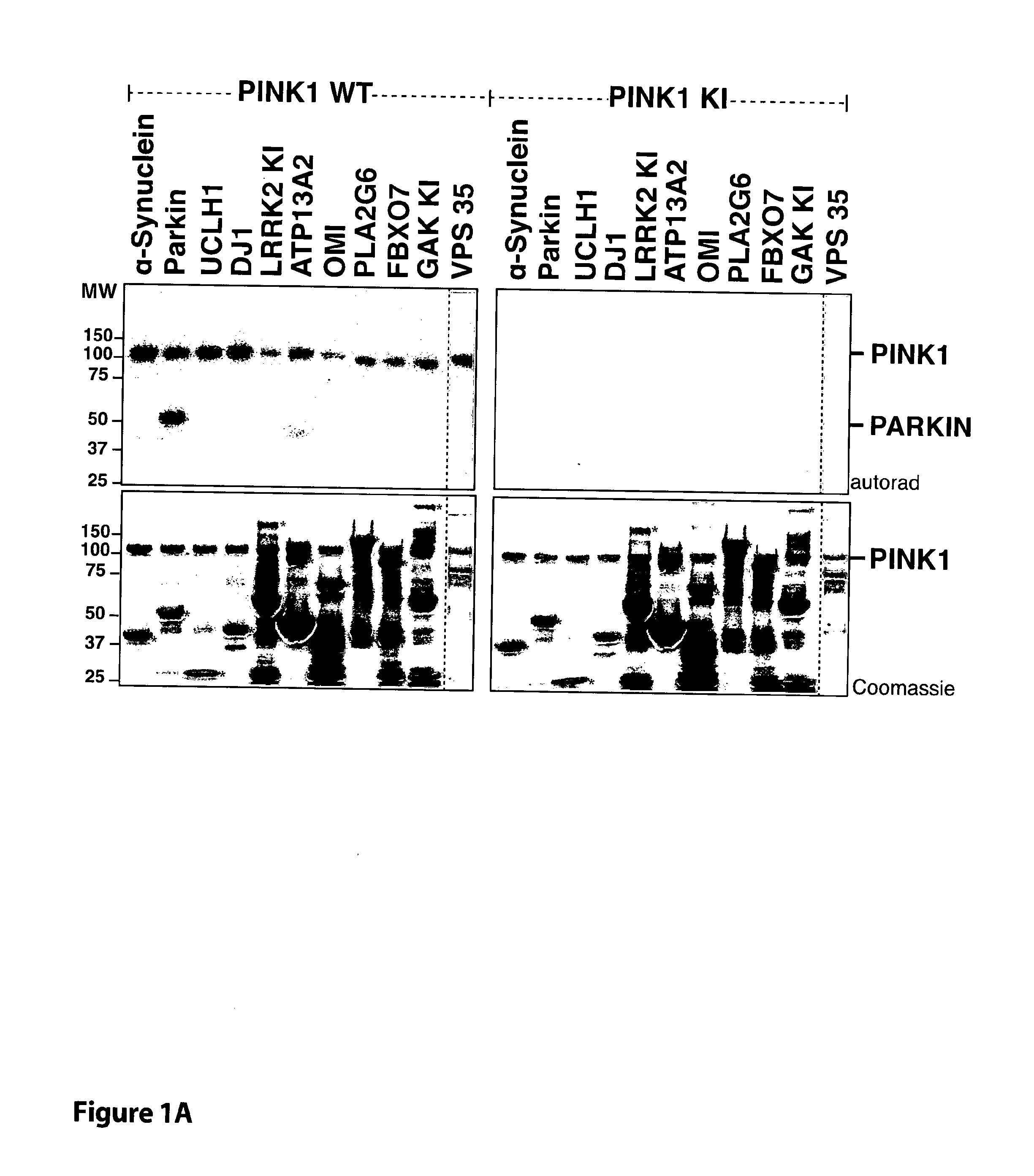 Parkinson's Disease Biomarker