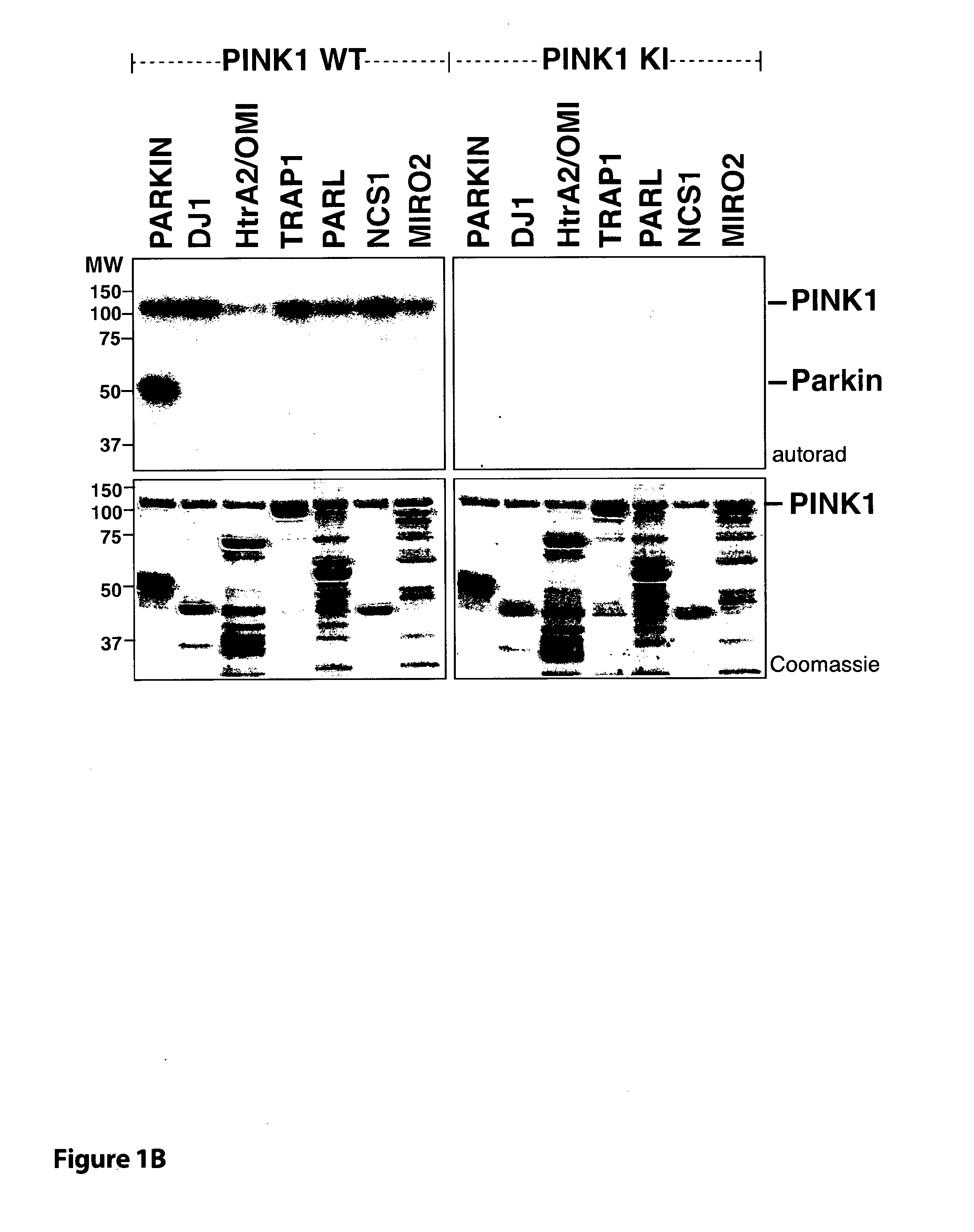 Parkinson's Disease Biomarker