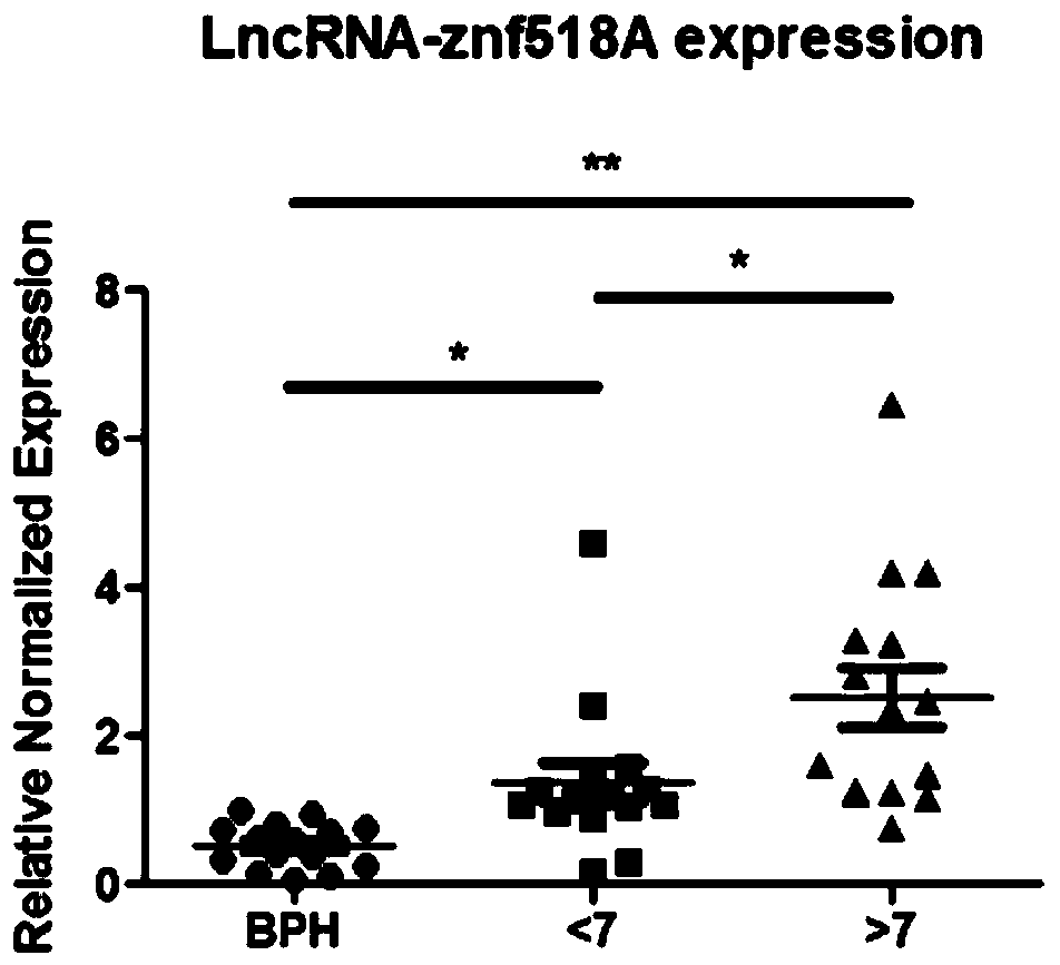 Marker LncRNA ZNF518A for diagnosing castration-resistant prostate cancer and/or performing prognosis assessment, and application of marker LncRNA ZNF518A
