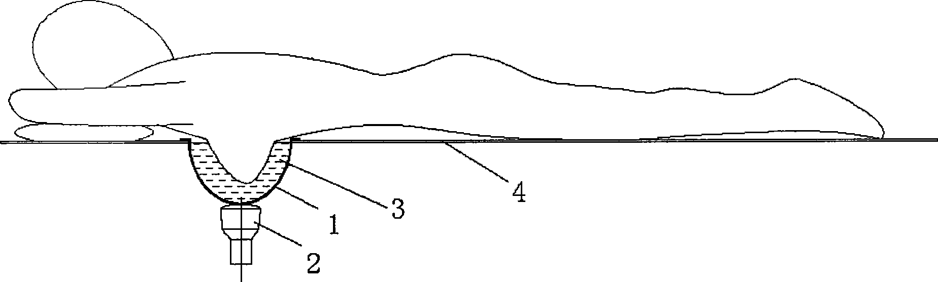 Glandula mammaria positioning device