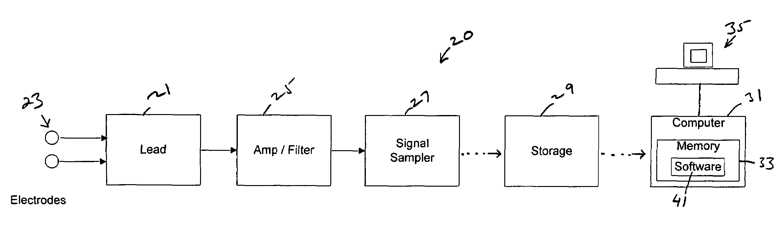 System, software, and method for detection of sleep-disordered breathing using an electrocardiogram