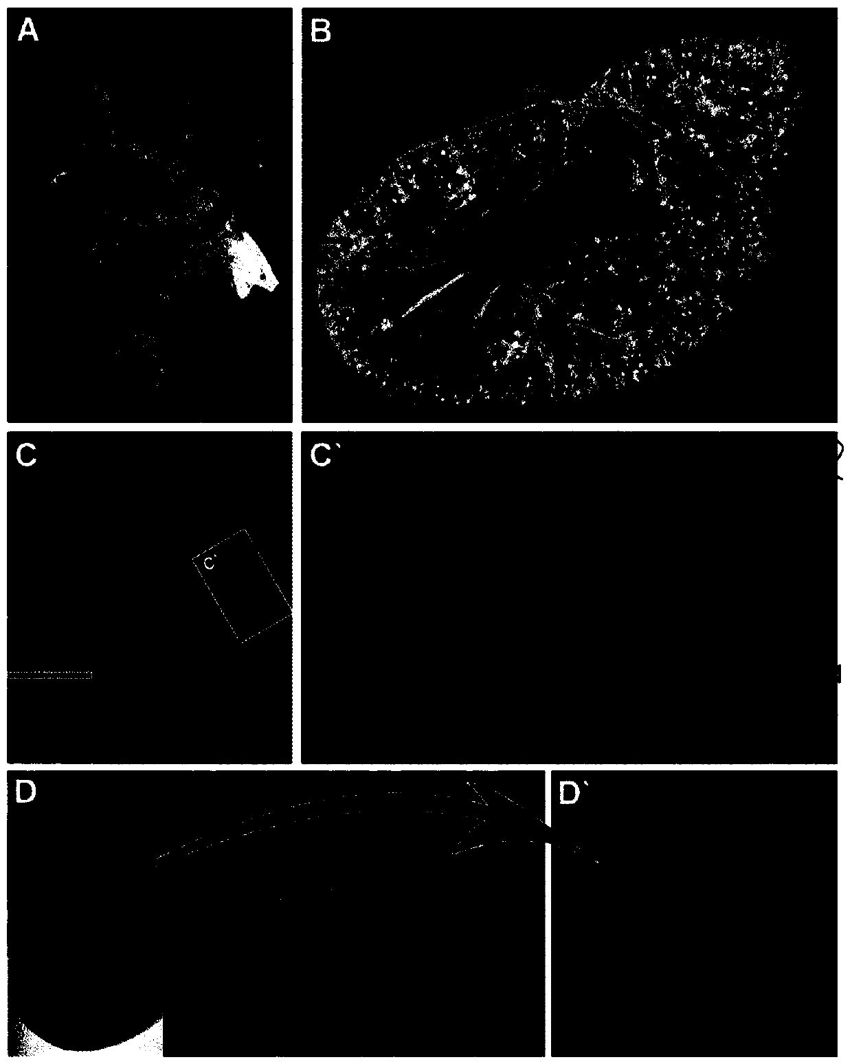 Contrast medium for microangiography