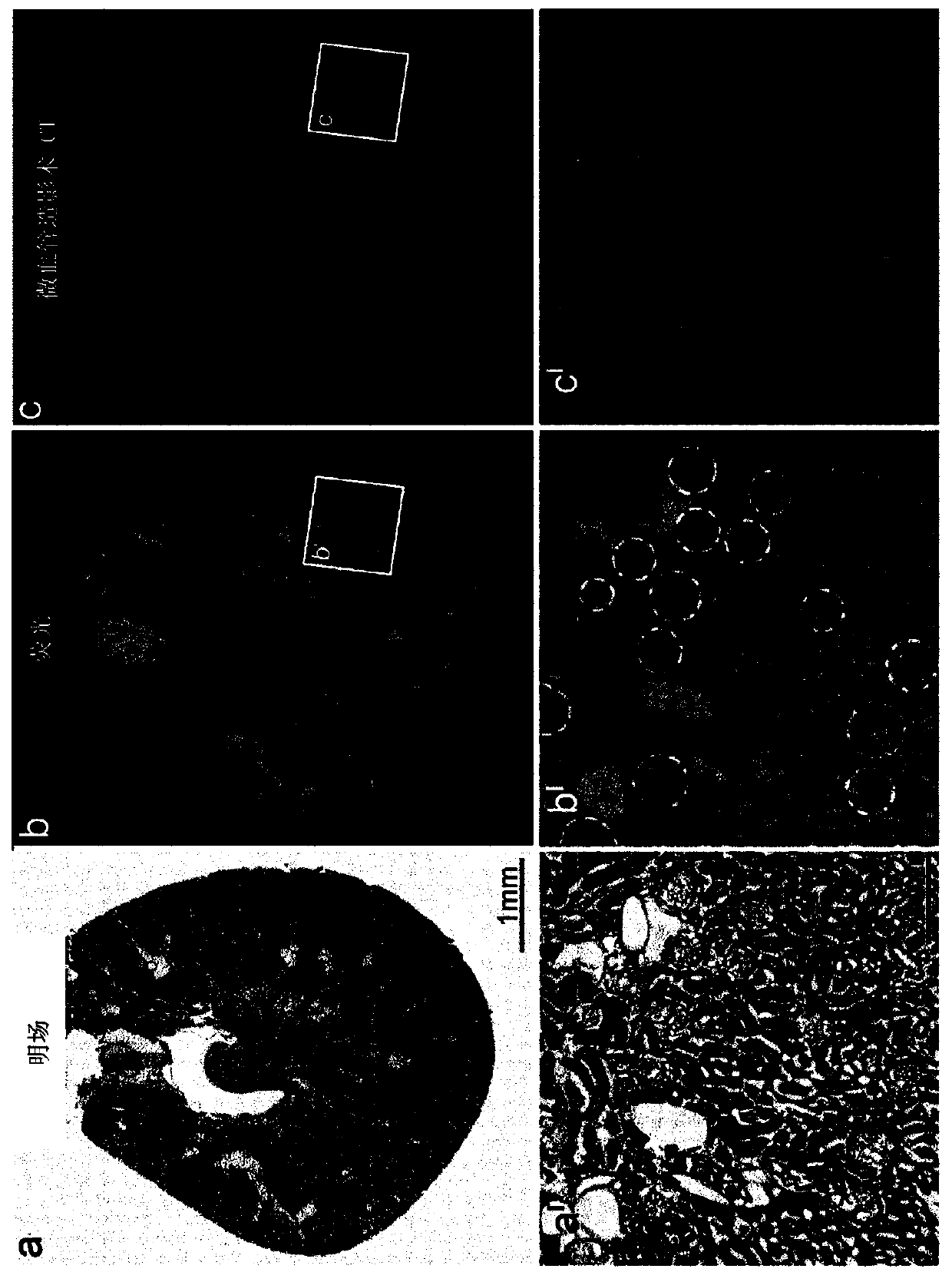 Contrast medium for microangiography