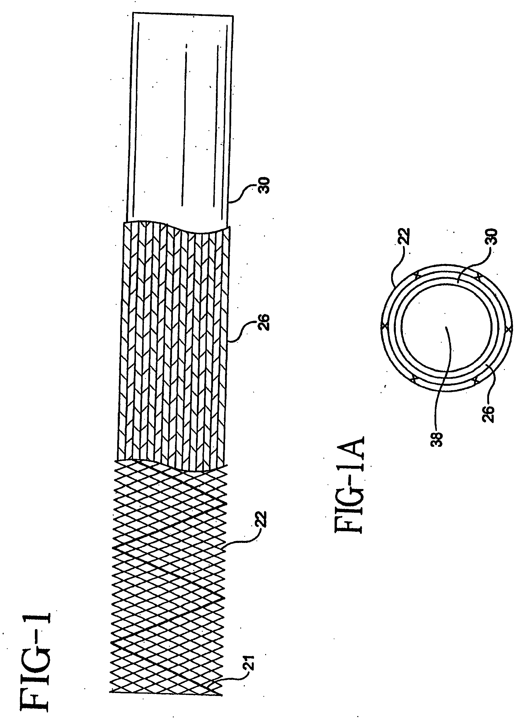 Stent-graft-membrane and method of making the same