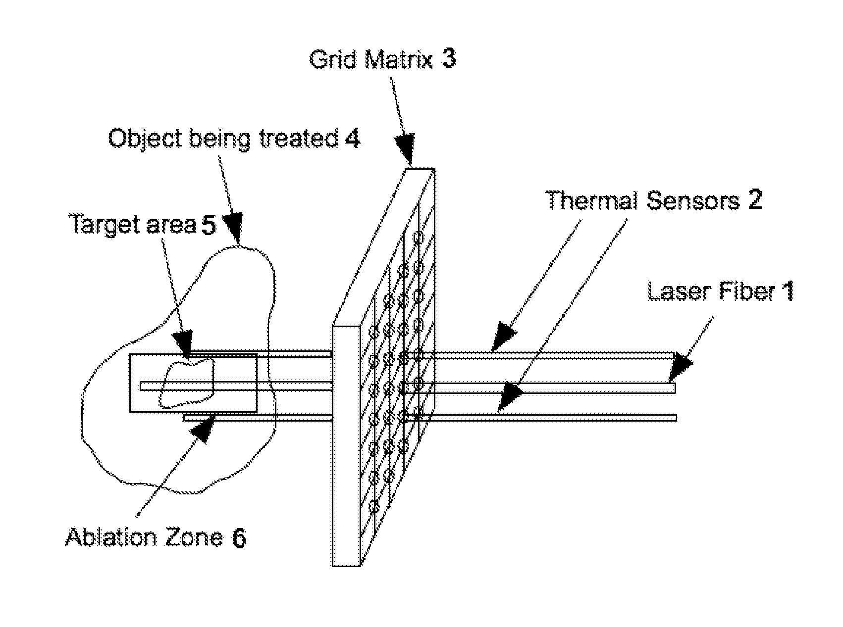 Method and apparatus for laser ablation under ultrasound guidance