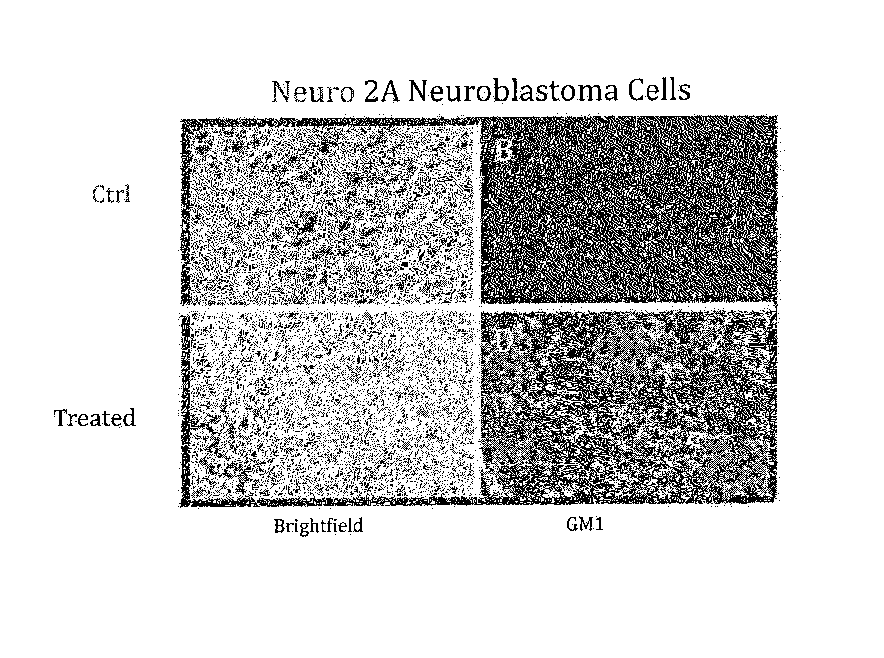 Methods of Ganglioside Production