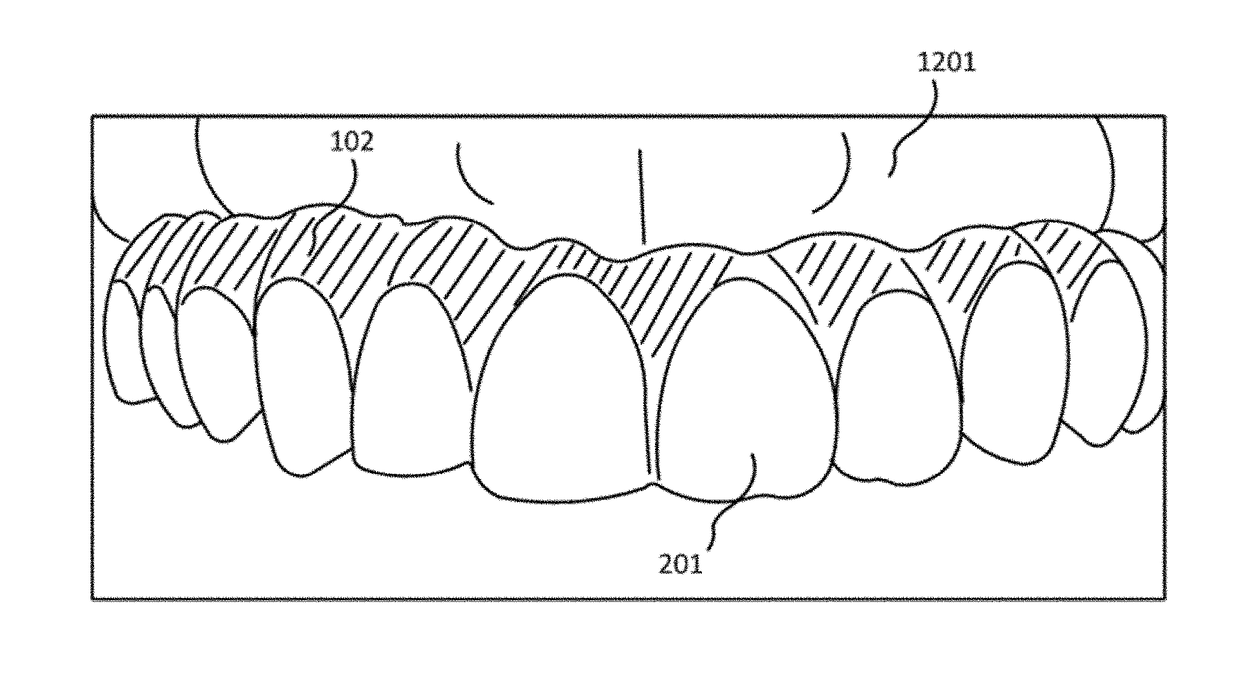 Method for duplicating a denture