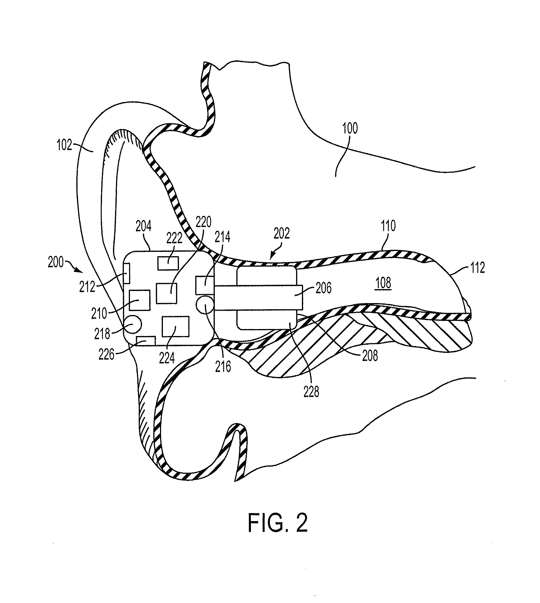 Methods and devices for occluding an ear canal having a predetermined filter characteristic