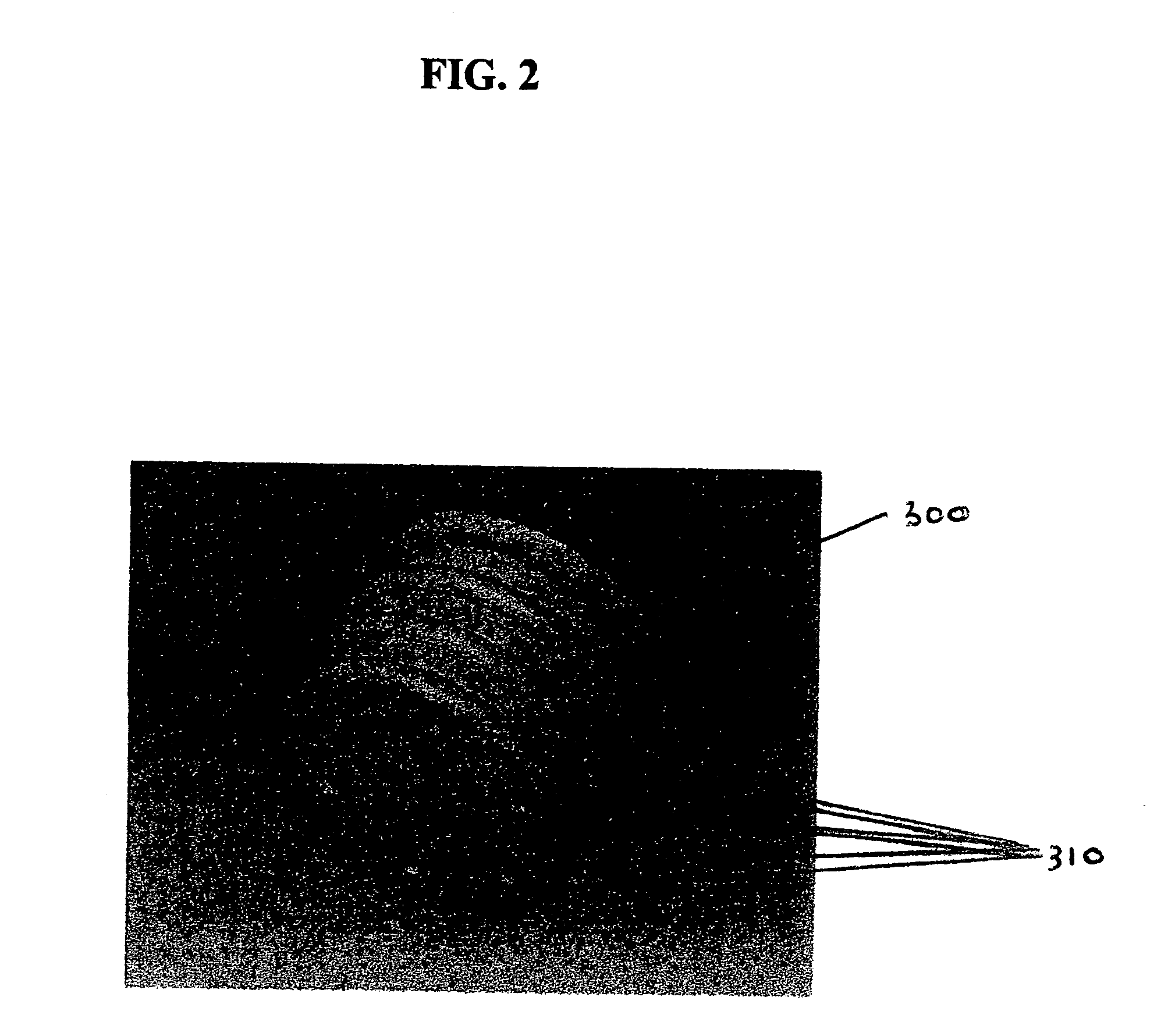 Container closure delivery system