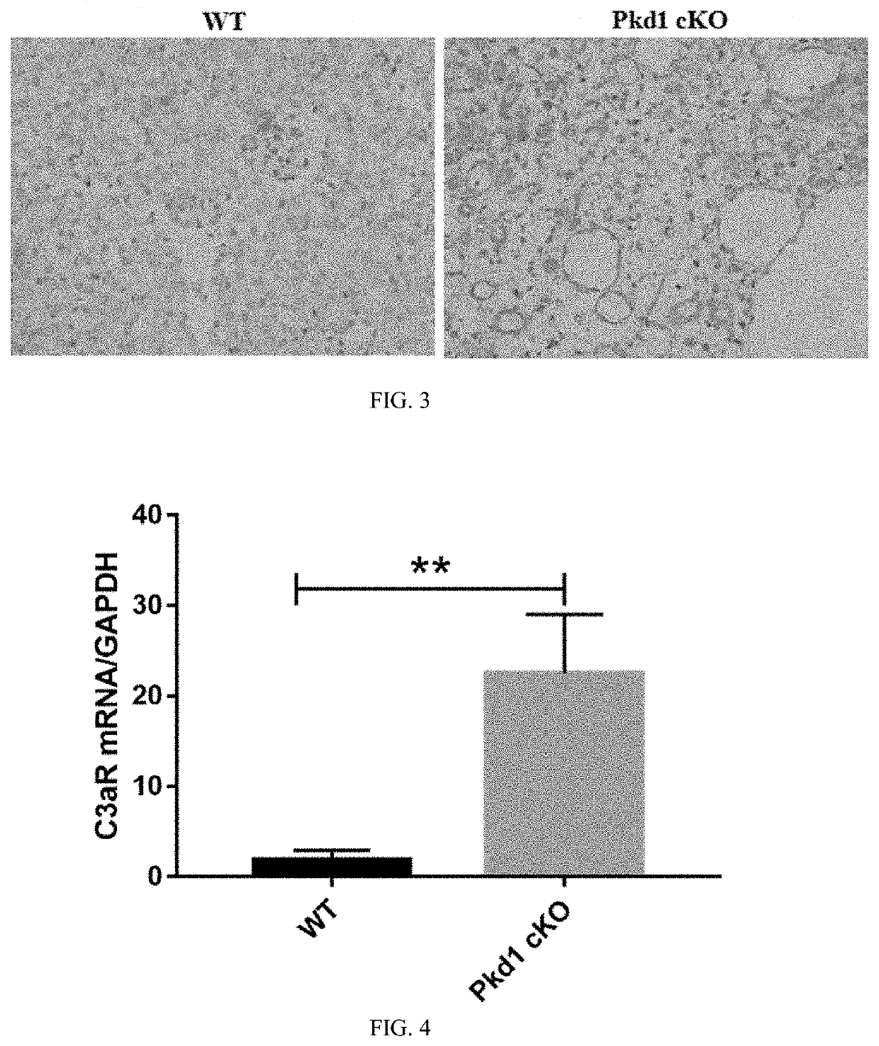 USE OF C3aR IN PREPARING DRUG FOR PREVENTING OR TREATING POLYCYSTIC KIDNEY DISEASE