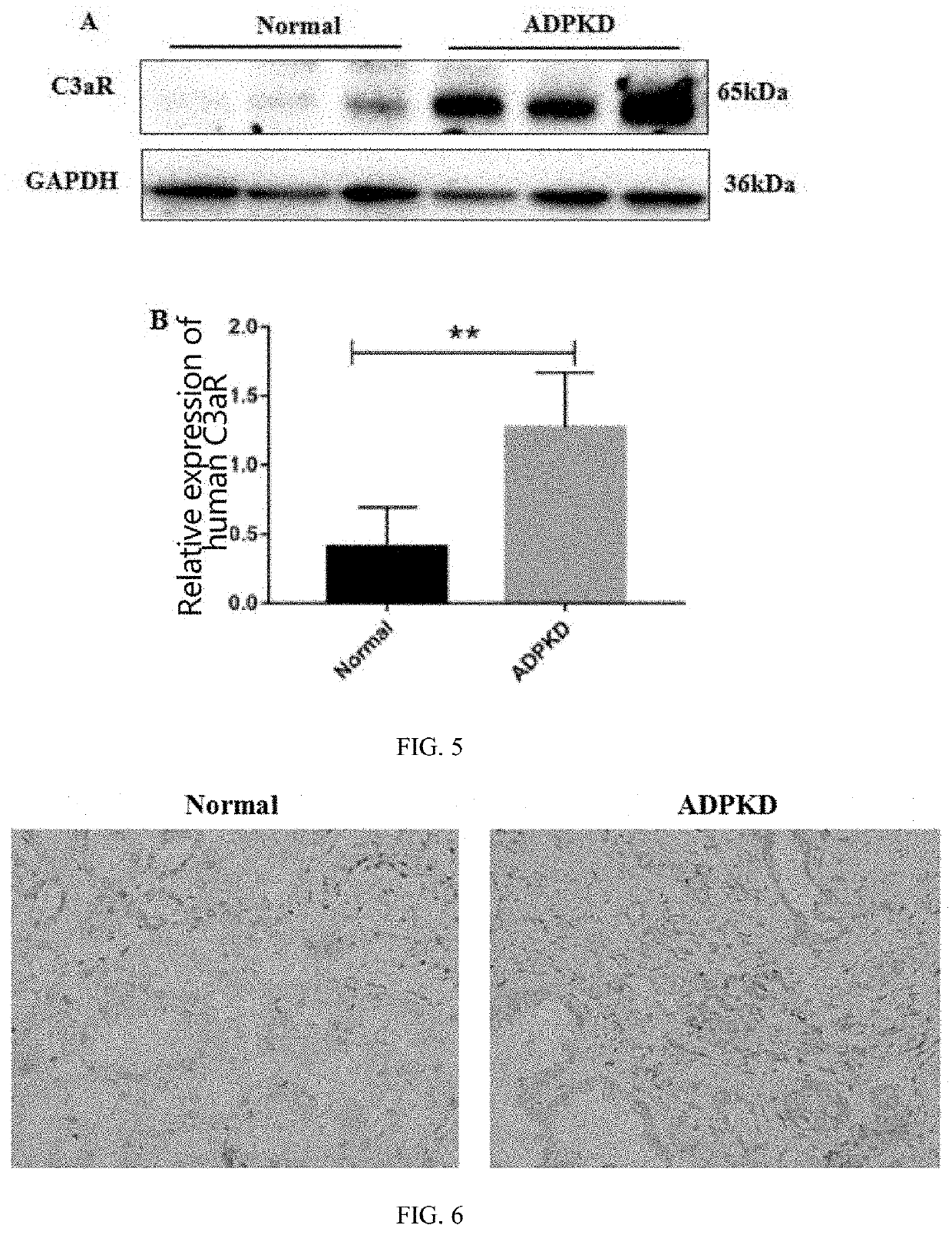 USE OF C3aR IN PREPARING DRUG FOR PREVENTING OR TREATING POLYCYSTIC KIDNEY DISEASE