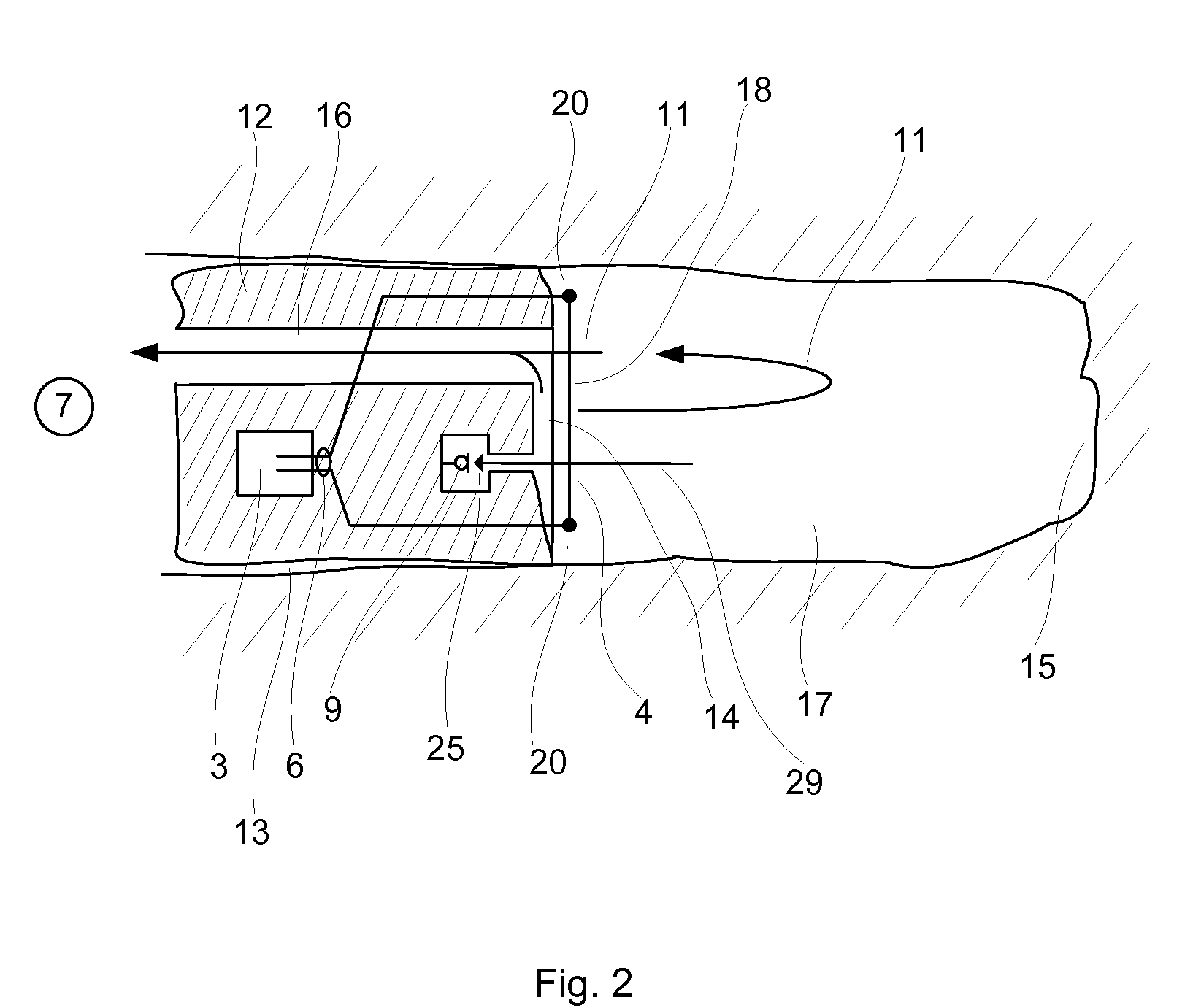 Hearing device