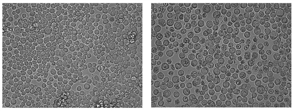 A blocking ELISA antibody detection kit based on ehdv core-like particles, preparation method and application