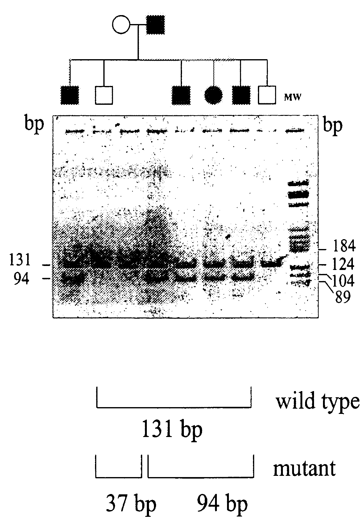 Mutations in the Ferroportin 1 Gene Associated with Hereditary Haemochromatosis