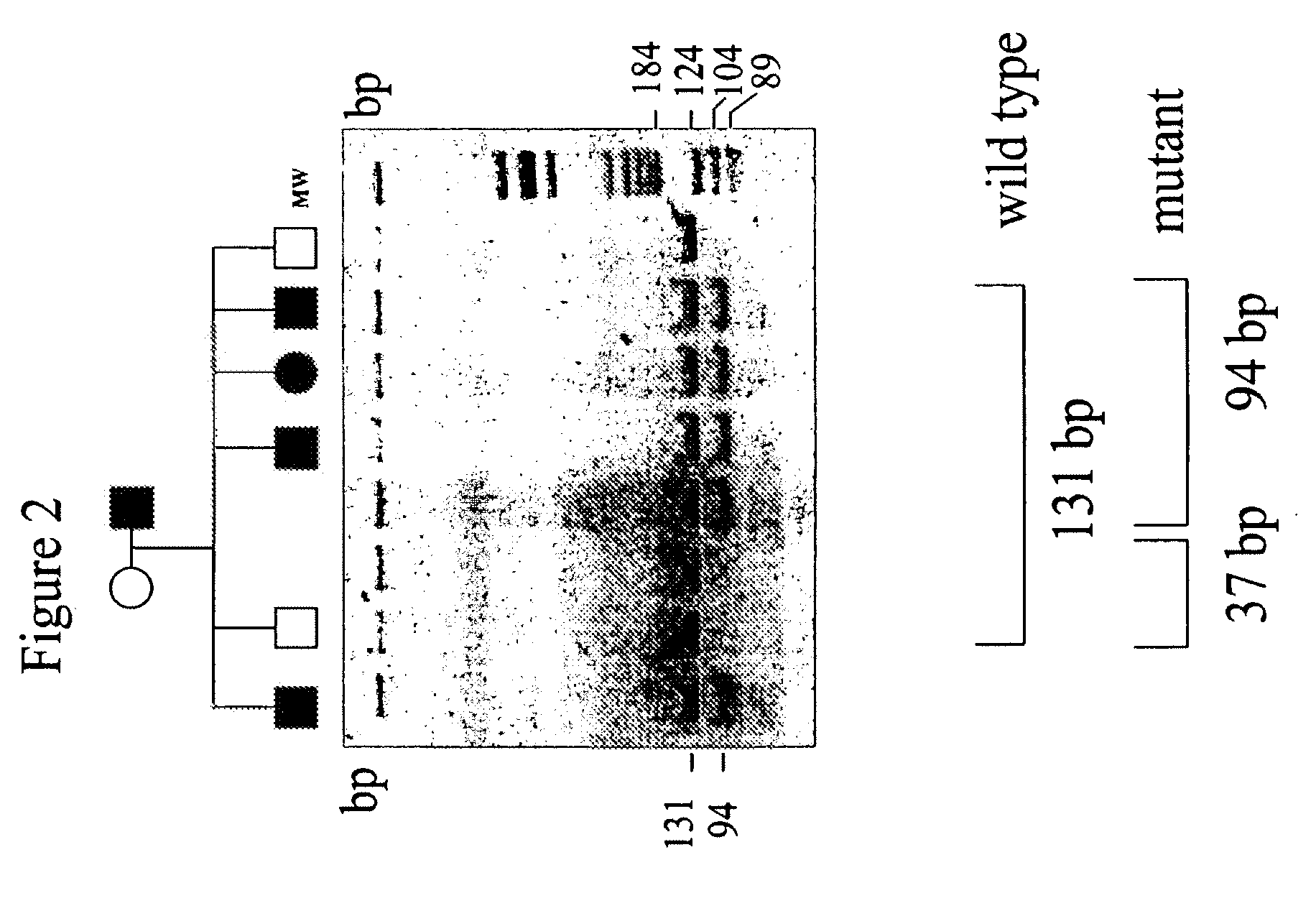 Mutations in the Ferroportin 1 Gene Associated with Hereditary Haemochromatosis