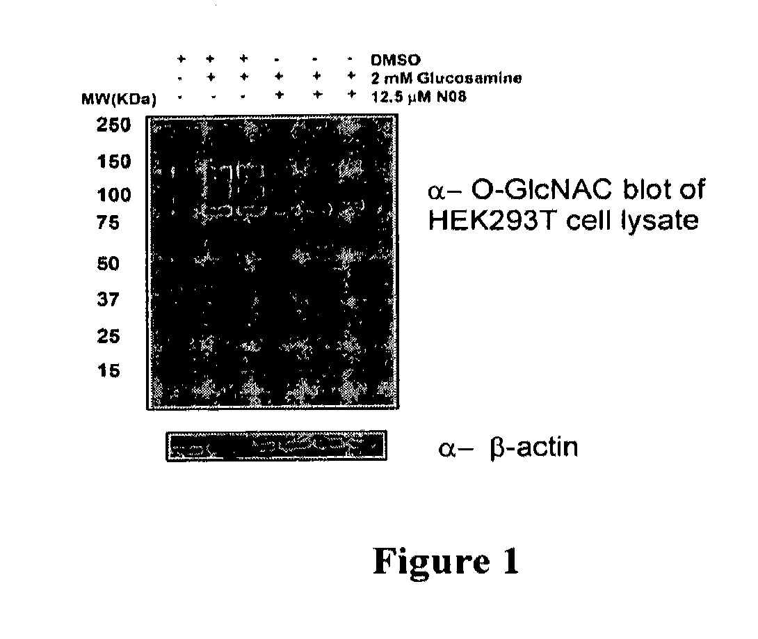 O-glcnac transferase inhibitors and uses thereof