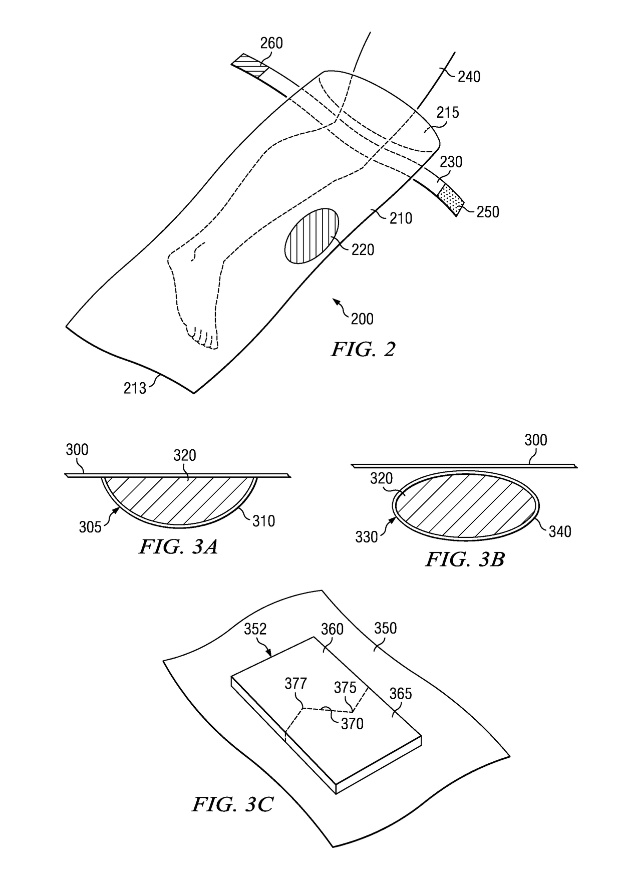 Apparatus and method for deploying a surgical preparation