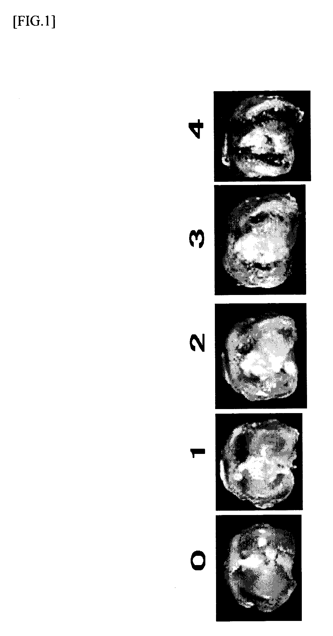 Pain remedy containing rock inhibitor