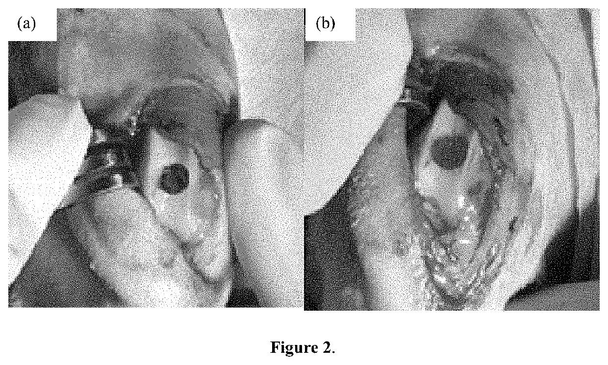 Devices and Methods for Repairing Cartilage and Osteochondral Defects