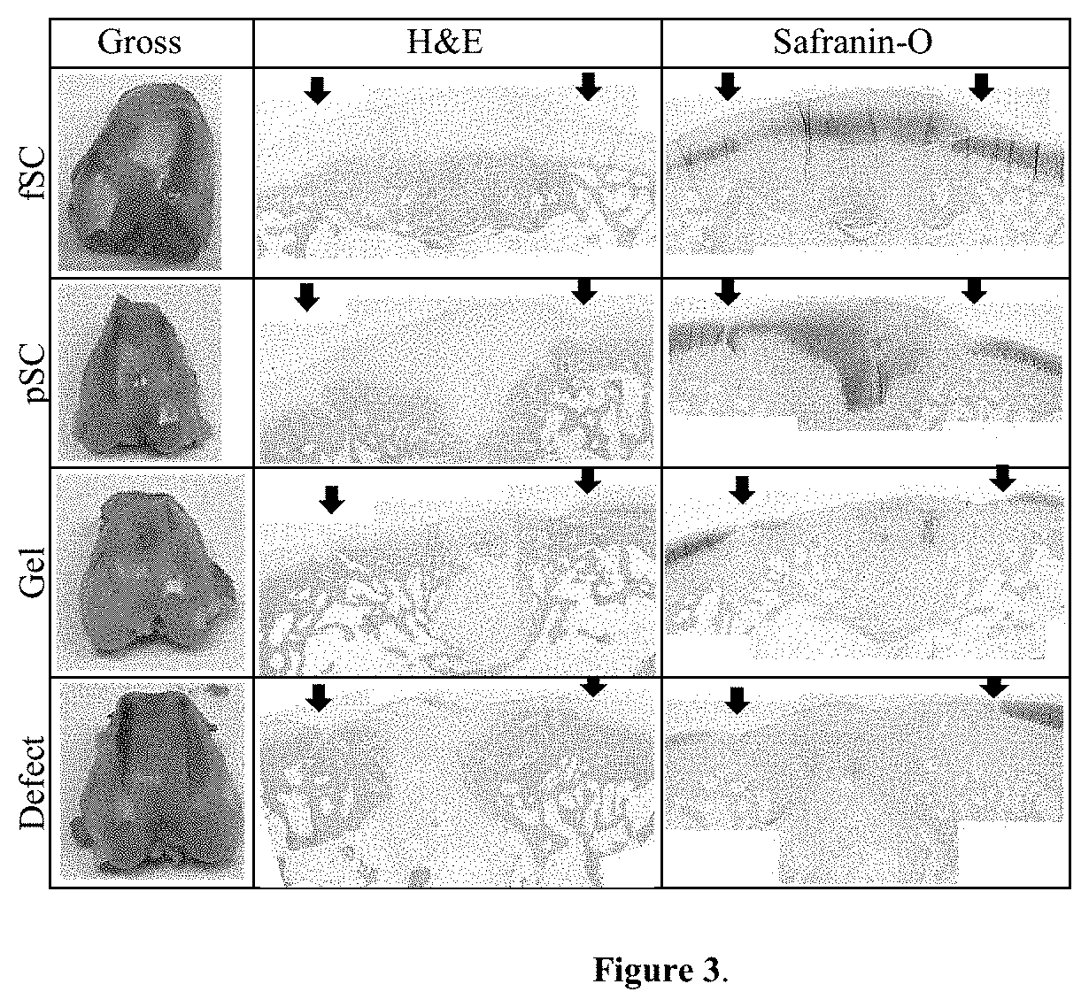 Devices and Methods for Repairing Cartilage and Osteochondral Defects