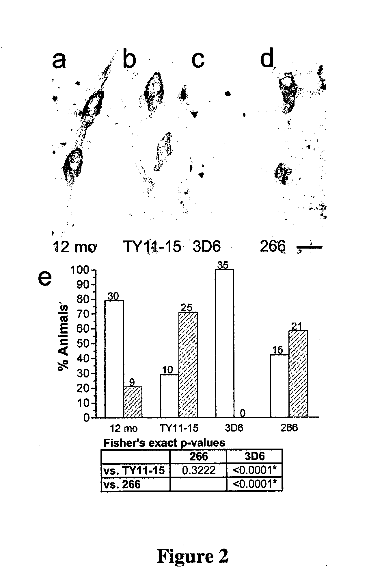 Prevention and treatment of cerebral amyloid angiopathy