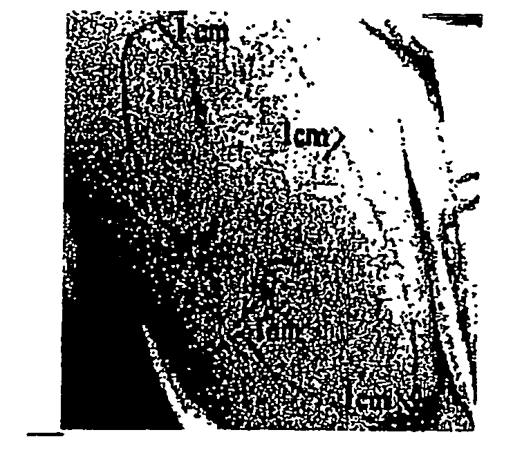 Compositions and Methods for Topical Application and Transdermal Delivery of Botulinum Toxins