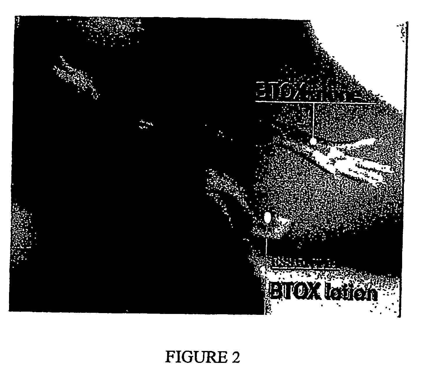 Compositions and Methods for Topical Application and Transdermal Delivery of Botulinum Toxins