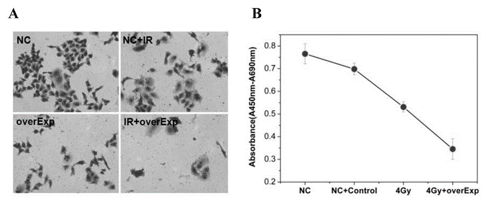 Application of PCBP1 gene in preparing radiotherapy sensitivity enhancing kit