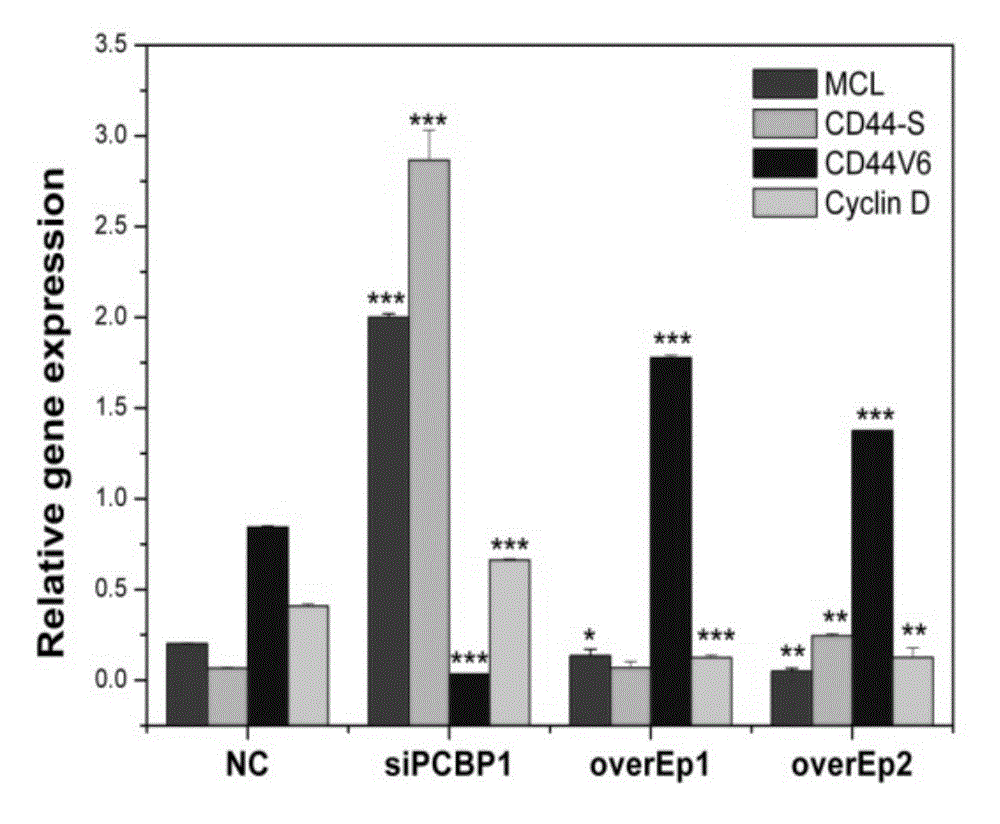 Application of PCBP1 gene in preparing radiotherapy sensitivity enhancing kit