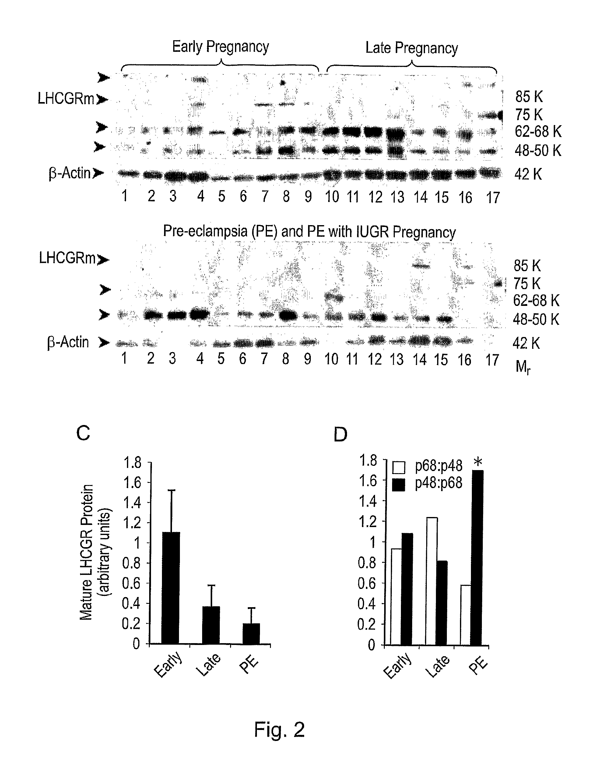 Diagnostic and therapeutic applications of soluble LHCGR protein