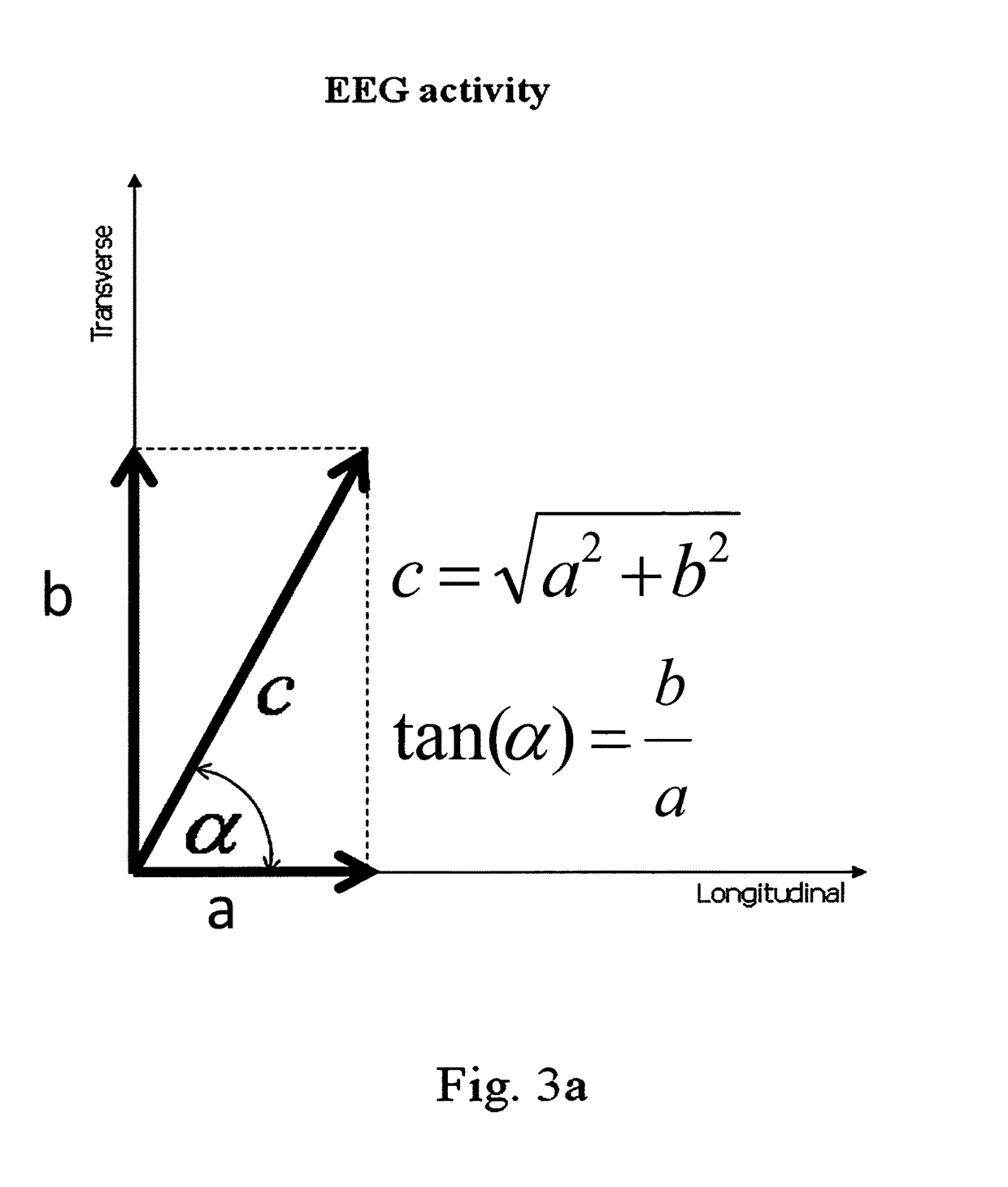 Device for use in electro-biological signal measurement in the presence of a magnetic field