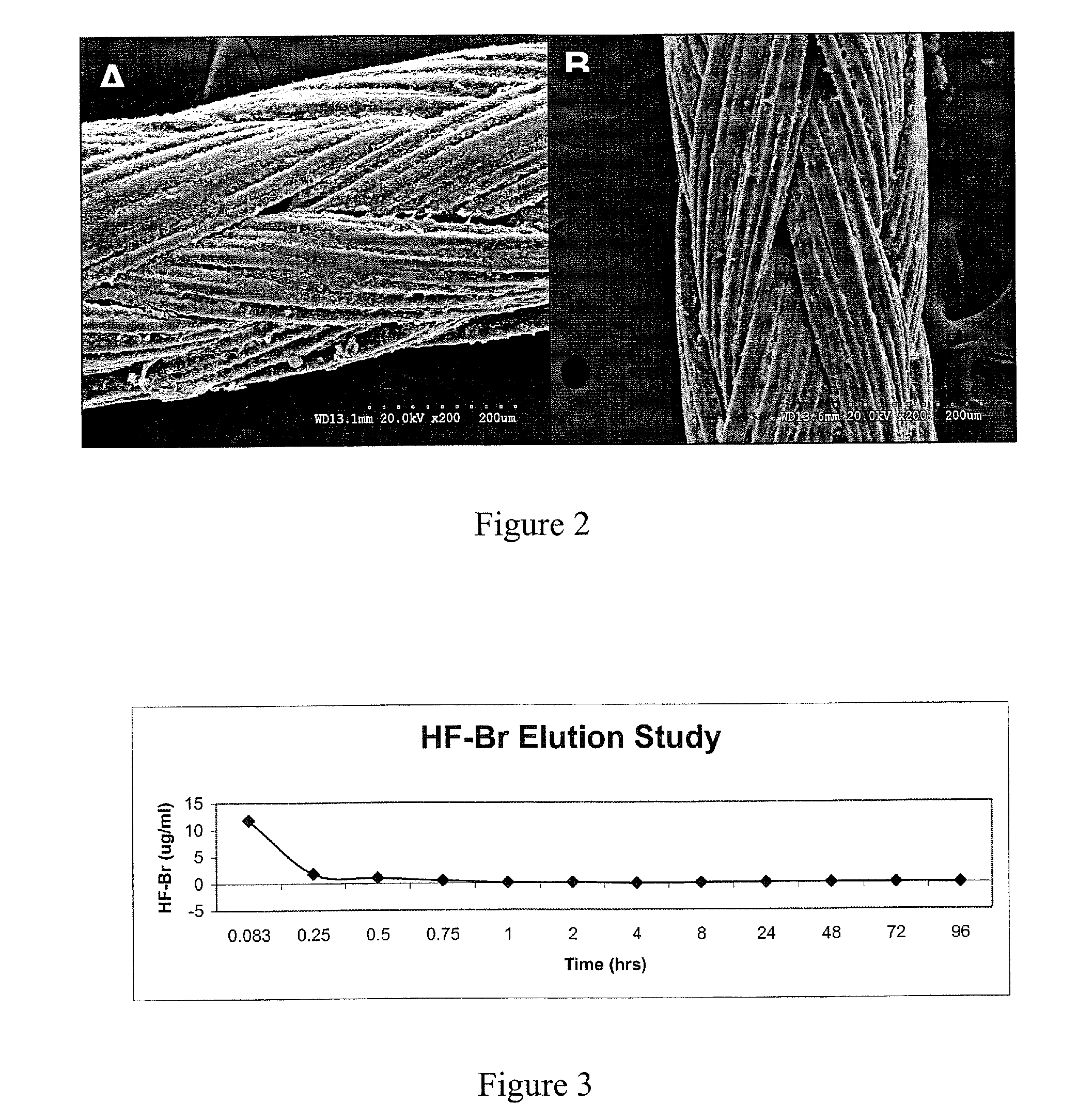 Medical devices incorporating collagen inhibitors