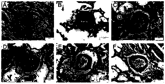 Use of aloperine in the preparation of drugs for the prevention and treatment of pulmonary arterial hypertension