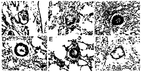 Use of aloperine in the preparation of drugs for the prevention and treatment of pulmonary arterial hypertension