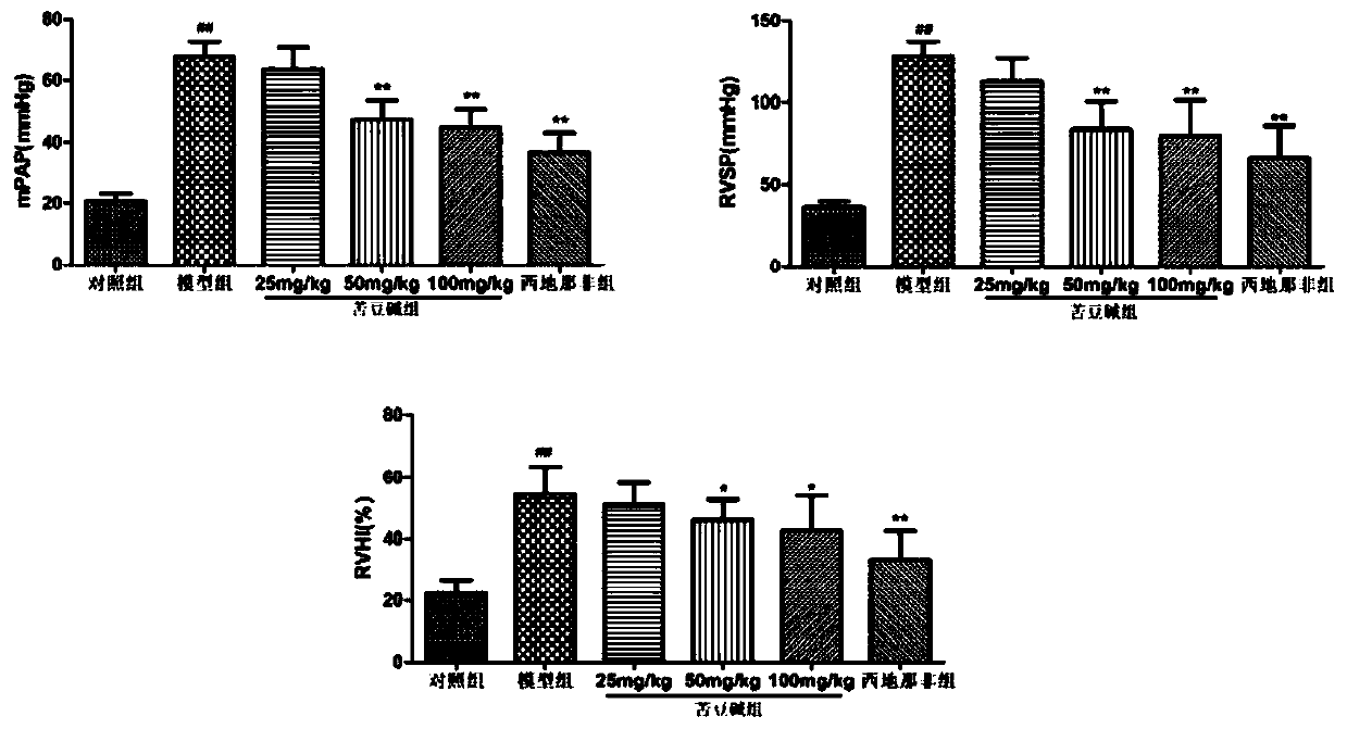 Use of aloperine in the preparation of drugs for the prevention and treatment of pulmonary arterial hypertension