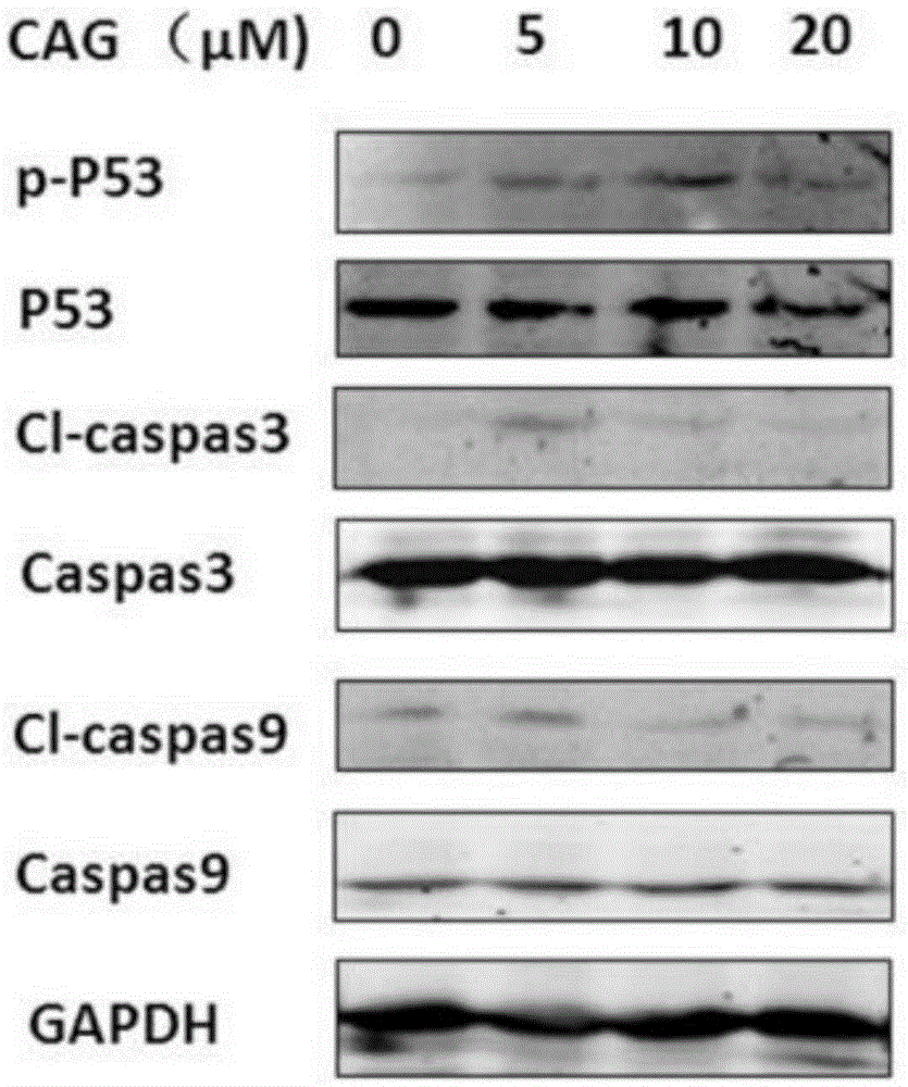 Application of cycloastragenol in preparation of drugs for protecting liver and promoting liver injury restoration