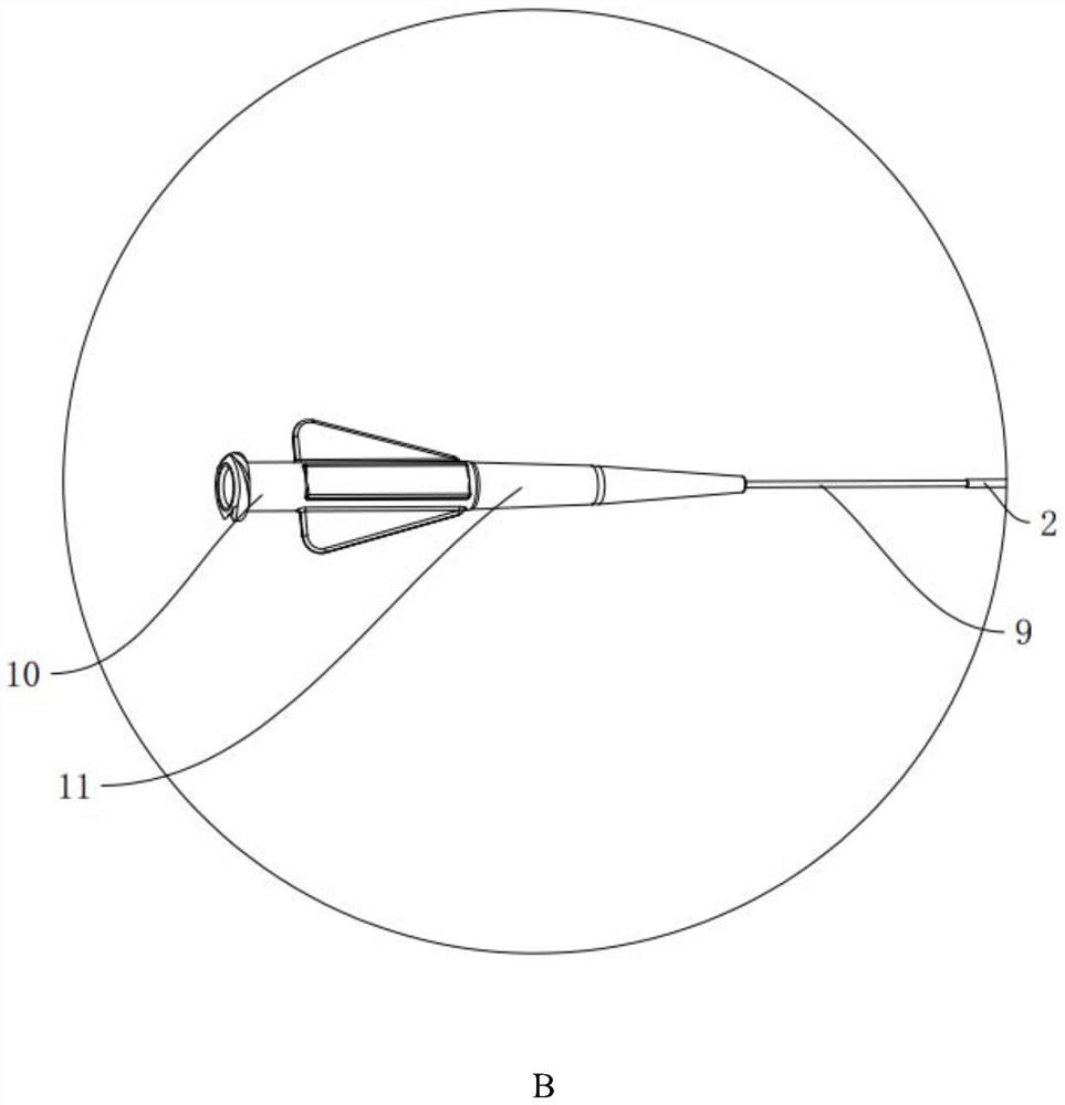 Spinous process balloon dilatation catheter